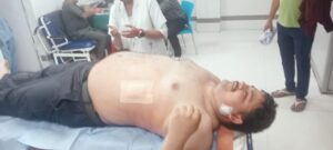 Singrauli News: कहा सुनी के बीच एनसीएल कर्मी ने टाइम कीपर पर चाकू से किया हमला, घायल अवस्था में नेहरू में भर्ती