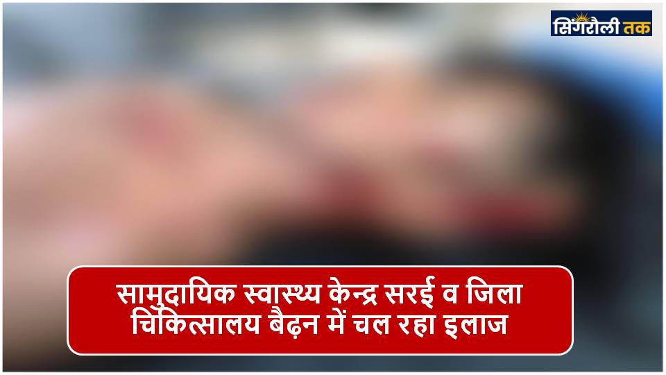 Singrauli News : बोलेरो वाहन के टक्कर से बाईक सवार दो बालक घायल