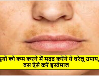 झाइयों को कम करने में मदद करेंगे ये घरेलू उपाय, बस ऐसे करें इस्तेमाल