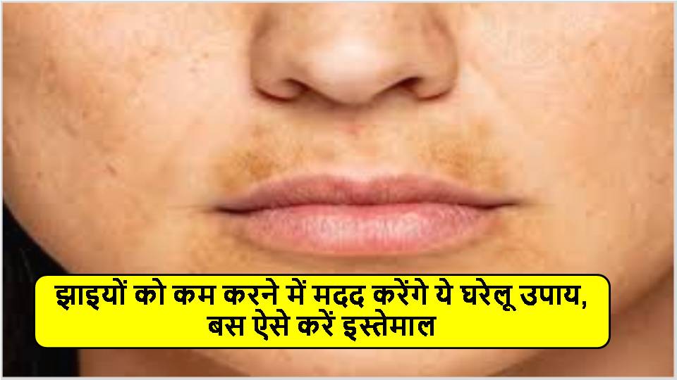 झाइयों को कम करने में मदद करेंगे ये घरेलू उपाय, बस ऐसे करें इस्तेमाल